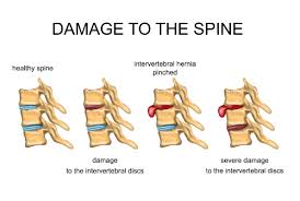 Alleviate Sciatica Pain with These Simple Stretches: Easy and Effective Ways to Relieve Discomfort Caused by Sciatica